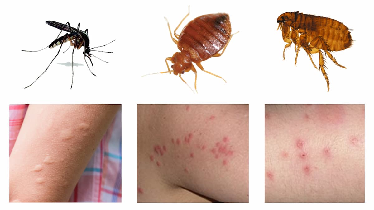 Photos de piqures associées à l'insecte responsable