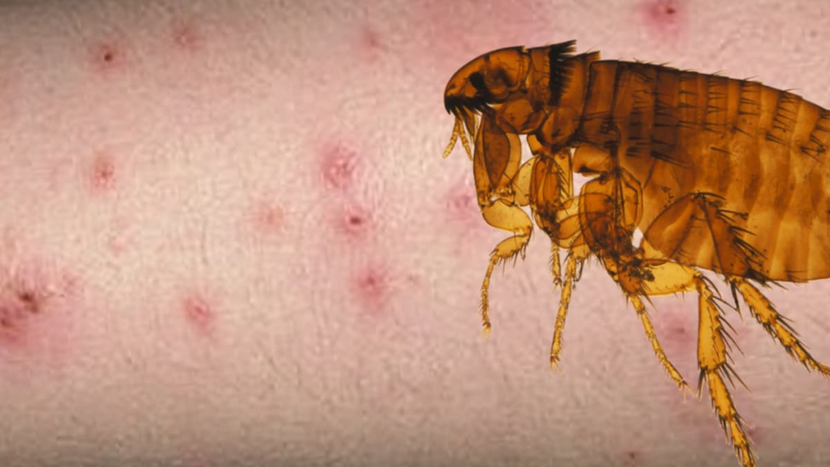 Piqure de puce de chat