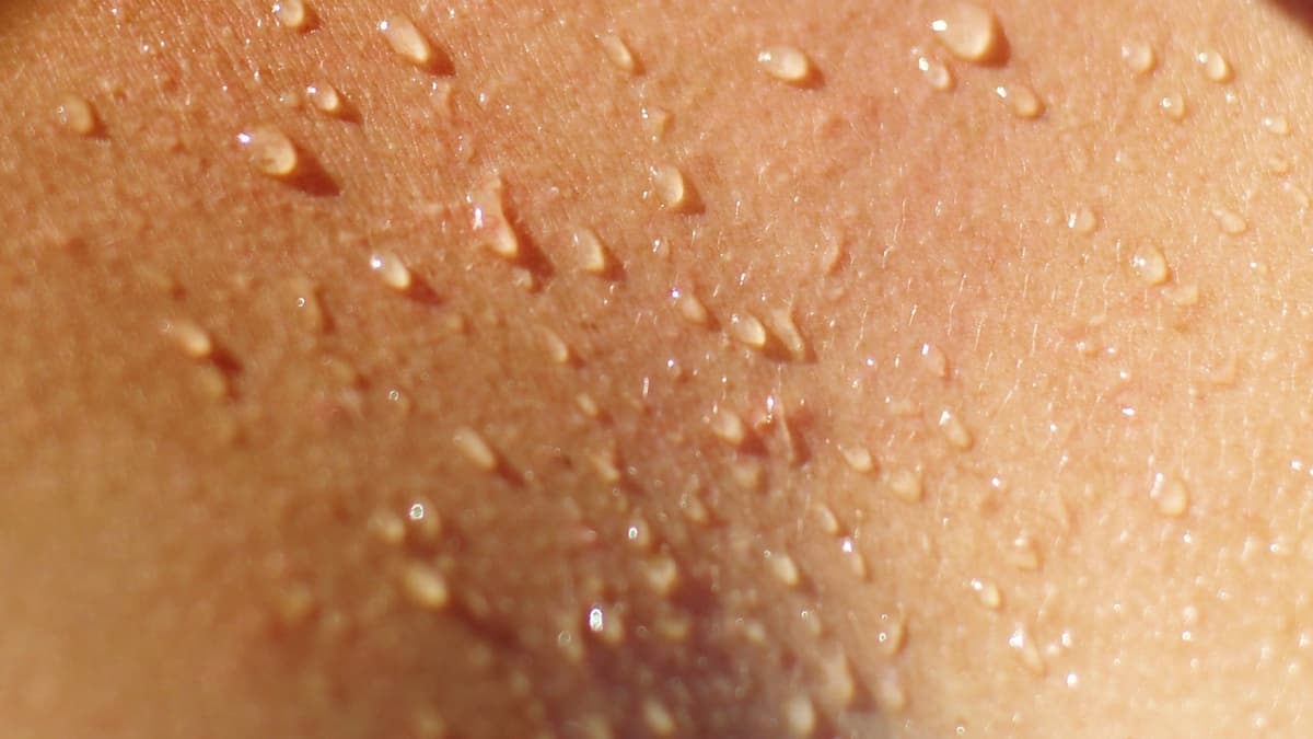 Peau humaine sécrétant de la transpiration